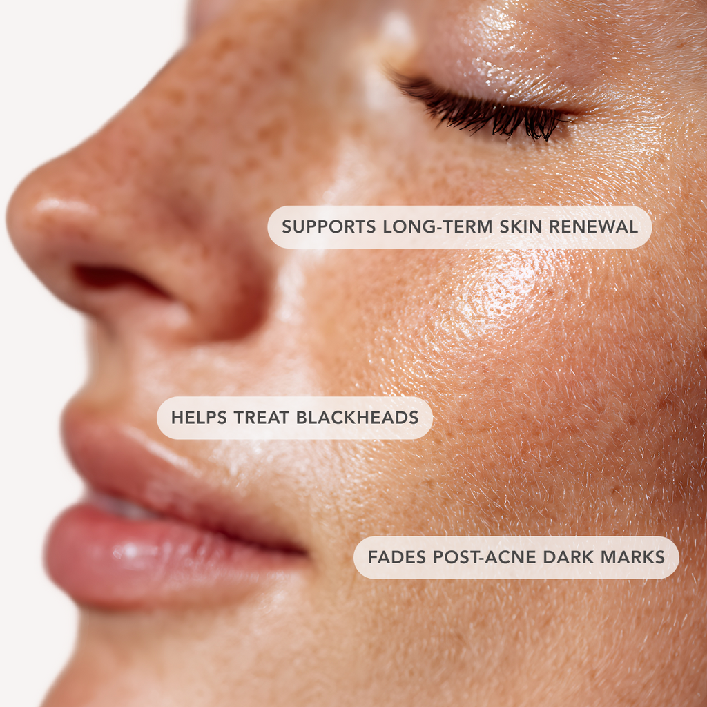 Blemish Control AHA 20%